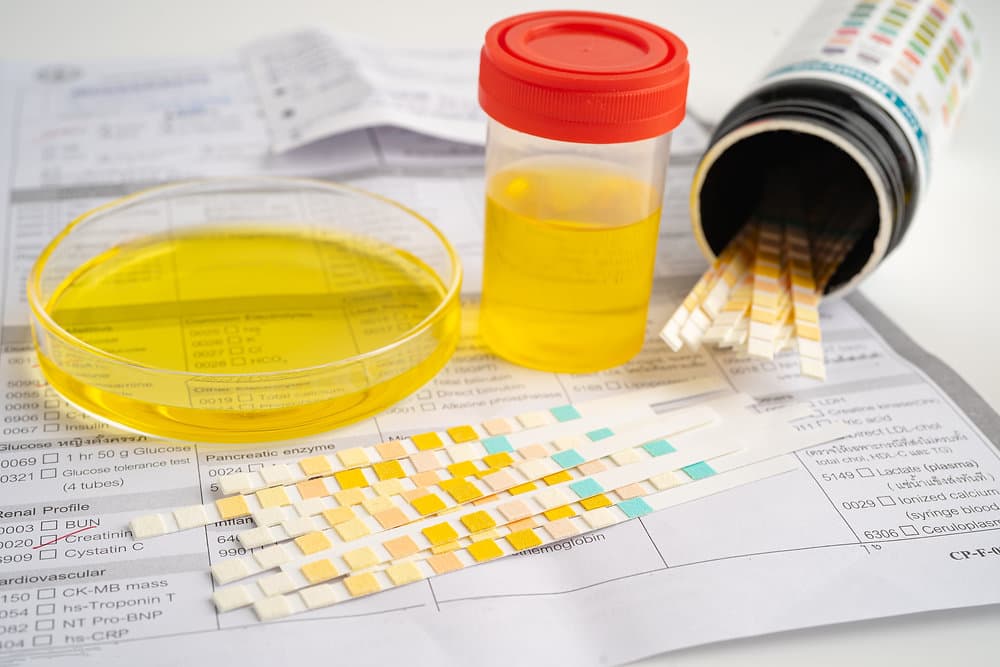 FMCSA Keeps Random Drug & Alcohol Testing Rates the Same for 2026